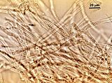 7 - Cellule midollari stellate